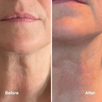 Bloomskin RegenMask LED & Microcurrent Mask for Lifting Jowls, Cheeks, and Lower Face